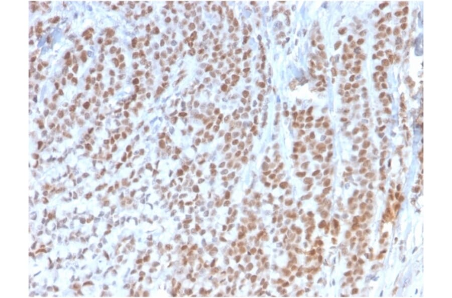 Immunohistochemistry - Anti-Rb1 Antibody [1F8] (A249832) - Antibodies.com