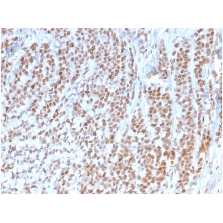 Immunohistochemistry - Anti-Rb1 Antibody [1F8] (A249832) - Antibodies.com
