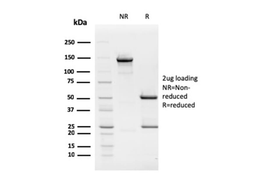 SDS-PAGE - Anti-Rb1 Antibody [1F8] (A249833) - Antibodies.com