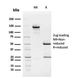 SDS-PAGE - Anti-Rb1 Antibody [1F8] (A249833) - Antibodies.com