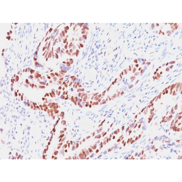 Immunohistochemistry - Anti-Rb1 Antibody [SPM353] (A249833) - Antibodies.com