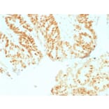 Immunohistochemistry - Anti-Rb1 Antibody [RB1/1754] (A249835) - Antibodies.com