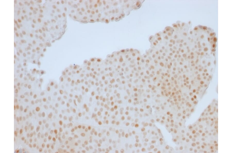 Immunohistochemistry - Anti-Rb1 Antibody [RB1/1754] (A249834) - Antibodies.com