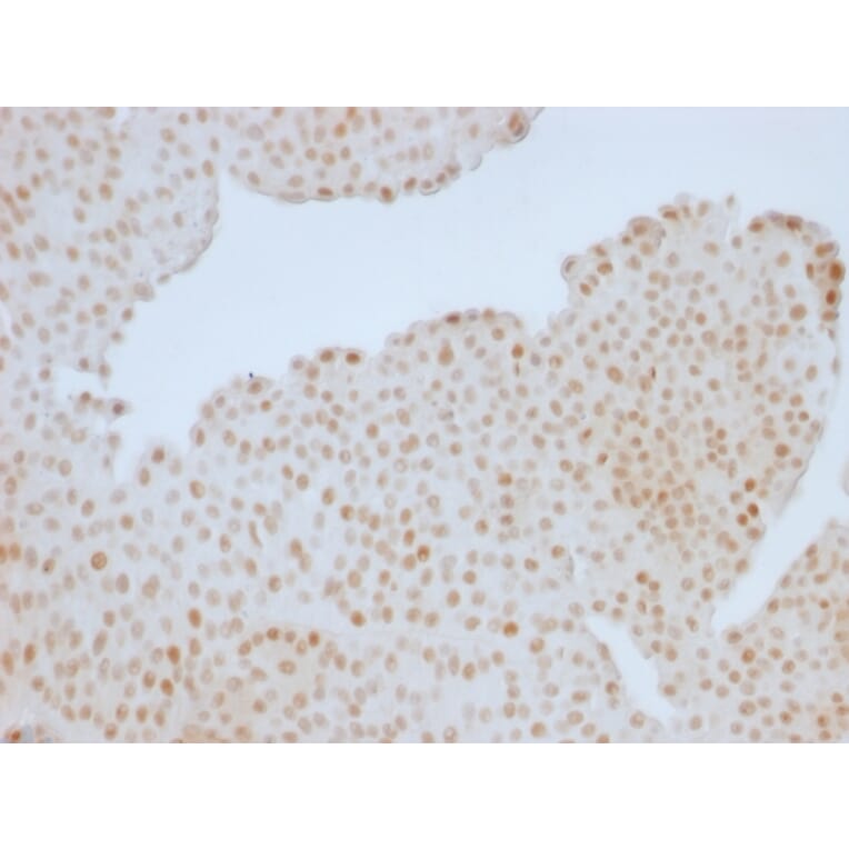 Immunohistochemistry - Anti-Rb1 Antibody [RB1/1754] (A249834) - Antibodies.com