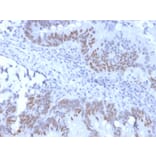 Immunohistochemistry - Anti-Rb1 Antibody [RB1/2313R] (A249835) - Antibodies.com