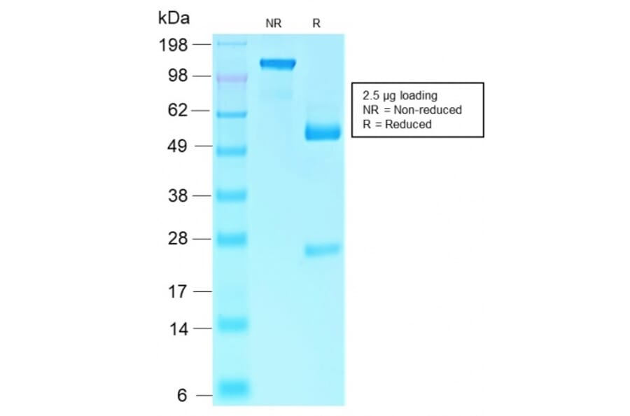 SDS-PAGE - Anti-Rb1 Antibody [RB1/2313R] (A249836) - Antibodies.com