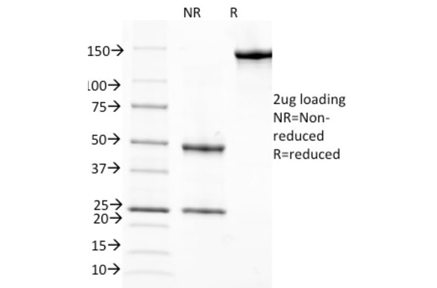 SDS-PAGE - Anti-Retinol Binding Protein Antibody [G4E4] (A249837) - Antibodies.com