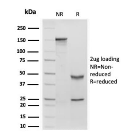 SDS-PAGE - Anti-Retinol Binding Protein Antibody [rRBP1/872] (A249840) - Antibodies.com