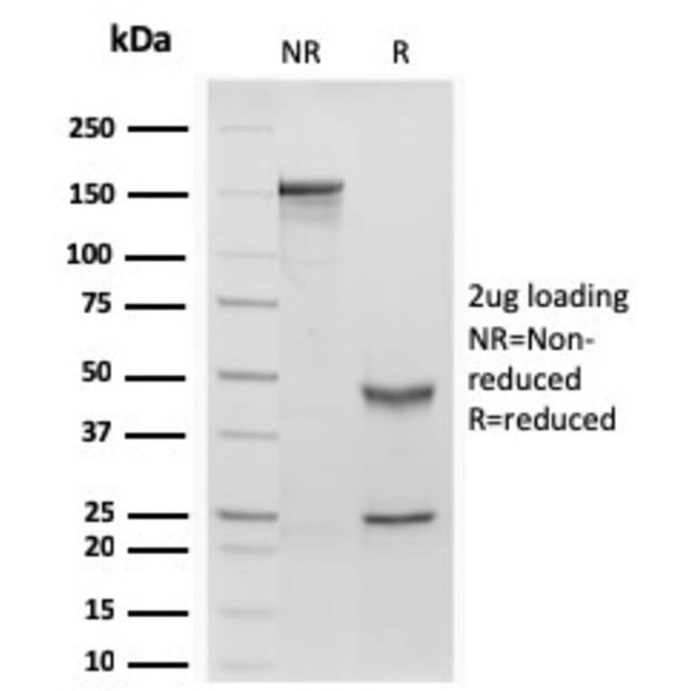 SDS-PAGE - Anti-Retinol Binding Protein Antibody [rRBP1/872] (A249840) - Antibodies.com