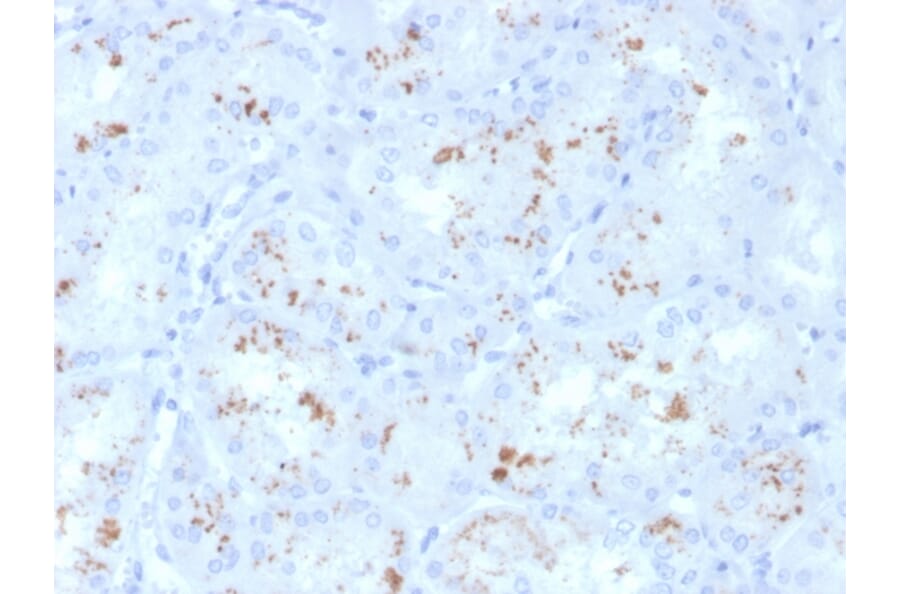Immunohistochemistry - Anti-RBP4 Antibody [RBP4/4050] (A249841) - Antibodies.com