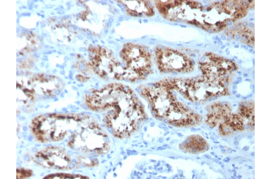 Immunohistochemistry - Anti-RBP4 Antibody [RBP4/4051] (A249842) - Antibodies.com