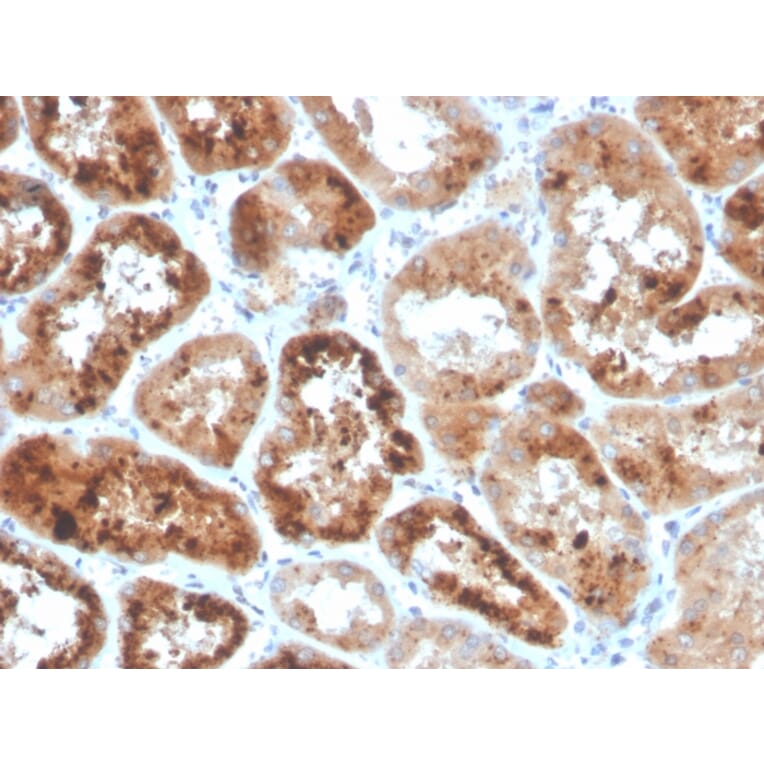 Immunohistochemistry - Anti-RBP4 Antibody [RBP4/4053] (A249843) - Antibodies.com