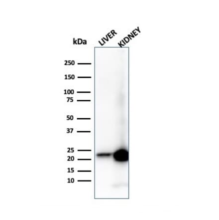Western Blot - Anti-RBP4 Antibody [RBP4/4314] (A249844) - Antibodies.com