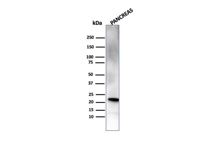 Western Blot - Anti-RBP4 Antibody [RBP4/4314] (A249844) - Antibodies.com