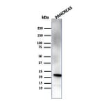 Western Blot - Anti-RBP4 Antibody [RBP4/4314] (A249844) - Antibodies.com