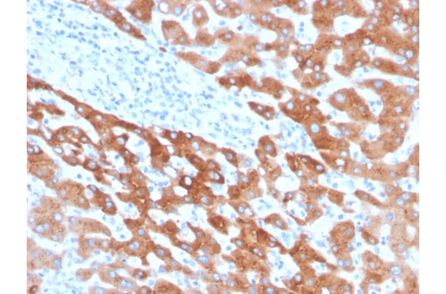 Immunohistochemistry - Anti-RBP4 Antibody [RBP4/4041] (A249846) - Antibodies.com