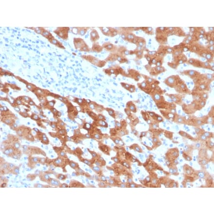Immunohistochemistry - Anti-RBP4 Antibody [RBP4/4041] (A249846) - Antibodies.com