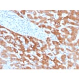 Immunohistochemistry - Anti-RBP4 Antibody [RBP4/4041] (A249846) - Antibodies.com