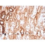 Immunohistochemistry - Anti-RBP4 Antibody [RBP4/4041] (A249846) - Antibodies.com