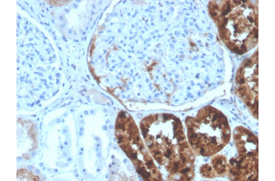 Immunohistochemistry - Anti-RBP4 Antibody [RBP4/4320] (A249847) - Antibodies.com
