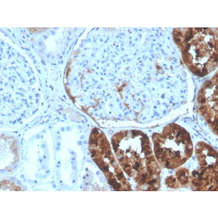 Immunohistochemistry - Anti-RBP4 Antibody [RBP4/4320] (A249847) - Antibodies.com