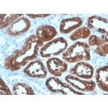 Immunohistochemistry - Anti-RBP4 Antibody [RBP4/4320] (A249847) - Antibodies.com