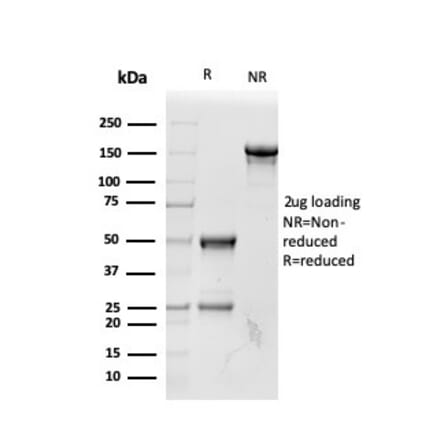 SDS-PAGE - Anti-RBP4 Antibody [RBP4/4042] (A249848) - Antibodies.com