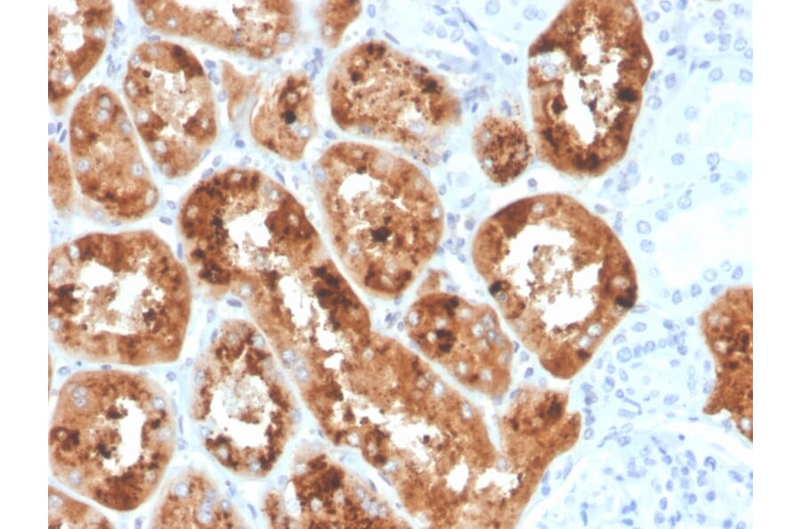 Immunohistochemistry - Anti-RBP4 Antibody [RBP4/4042] (A249848) - Antibodies.com