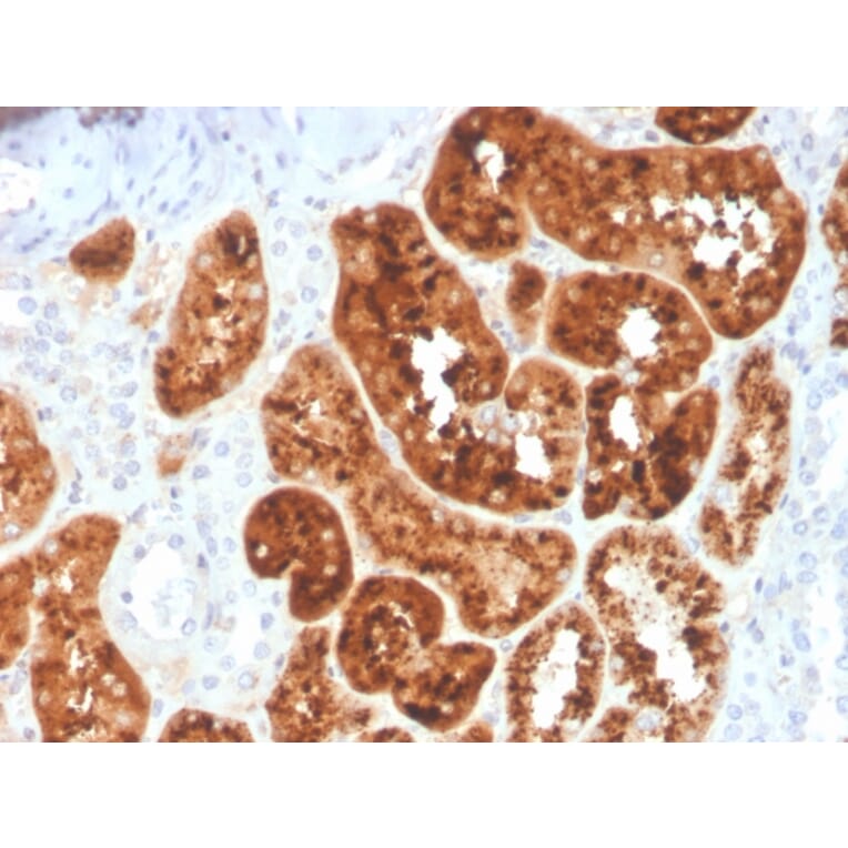 Immunohistochemistry - Anti-RBP4 Antibody [RBP4/4044] (A249850) - Antibodies.com
