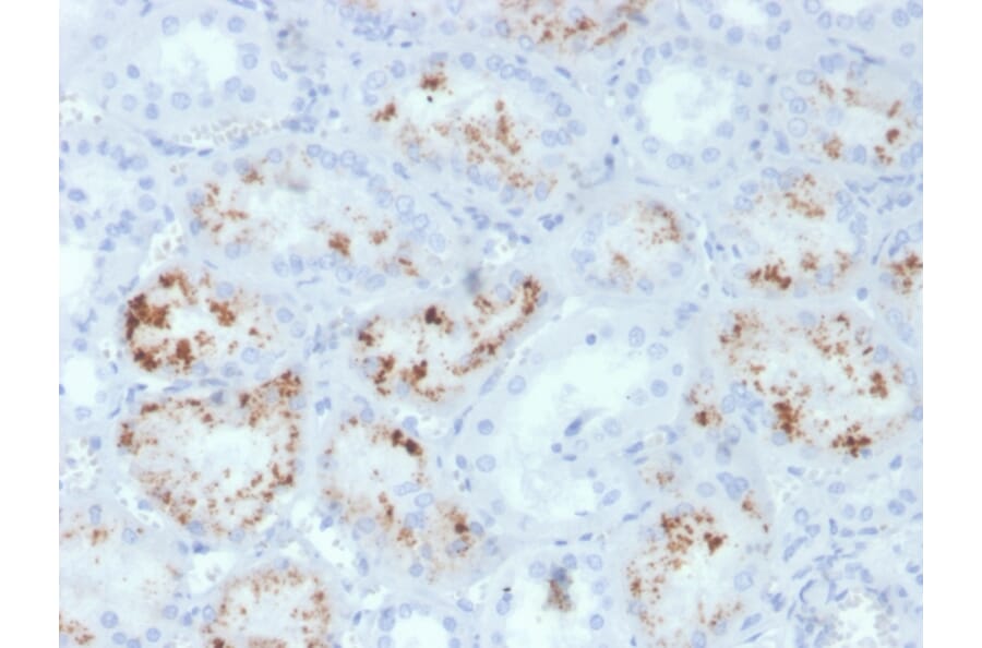 Immunohistochemistry - Anti-RBP4 Antibody [RBP4/4047] (A249852) - Antibodies.com