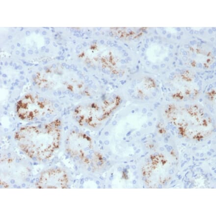 Immunohistochemistry - Anti-RBP4 Antibody [RBP4/4047] (A249852) - Antibodies.com