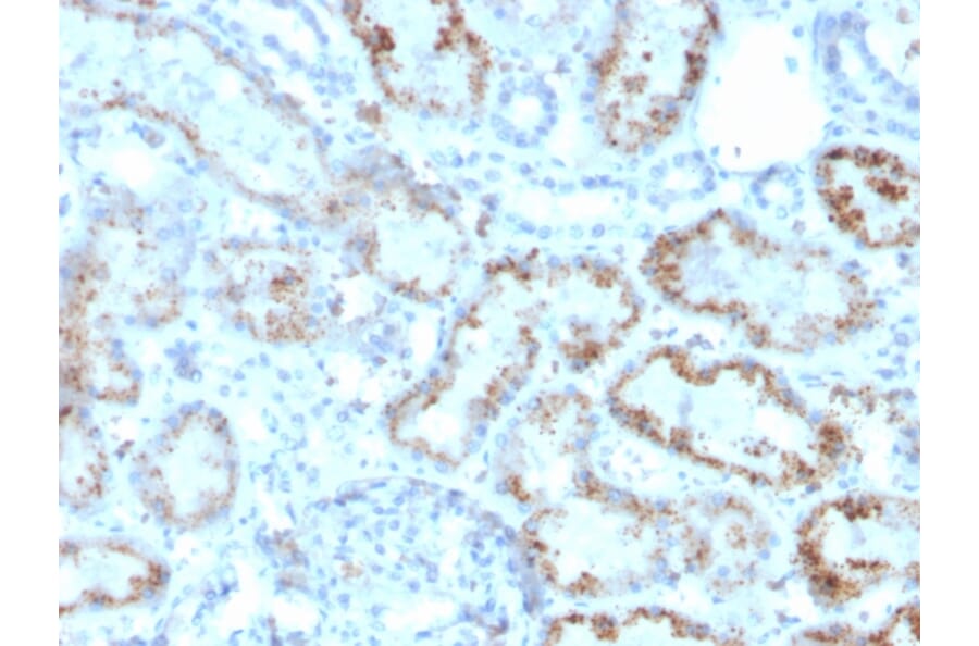 Immunohistochemistry - Anti-RBP4 Antibody [RBP4/4047] (A249852) - Antibodies.com