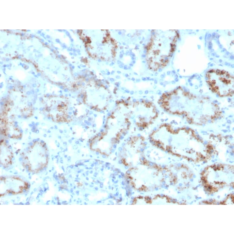 Immunohistochemistry - Anti-RBP4 Antibody [RBP4/4047] (A249852) - Antibodies.com