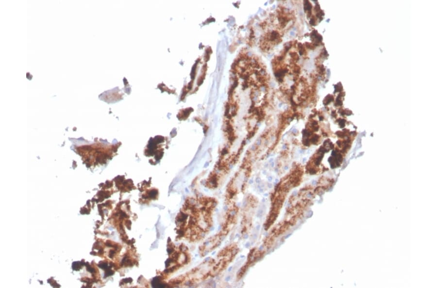 Immunohistochemistry - Anti-RBP4 Antibody [RBP4/4049] (A249854) - Antibodies.com