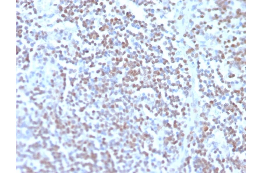 Immunohistochemistry - Anti-Cyclin D1 Antibody [rCCND1/4752] (A249854) - Antibodies.com