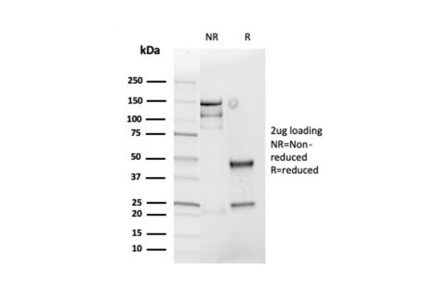 SDS-PAGE - Anti-Cyclin D1 Antibody [rCCND1/4752] (A249855) - Antibodies.com