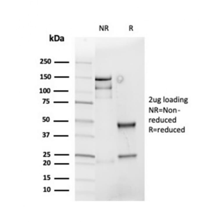 SDS-PAGE - Anti-Cyclin D1 Antibody [rCCND1/4752] (A249855) - Antibodies.com