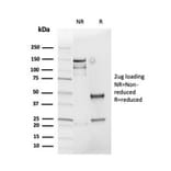 SDS-PAGE - Anti-Cyclin D1 Antibody [rCCND1/4752] (A249855) - Antibodies.com