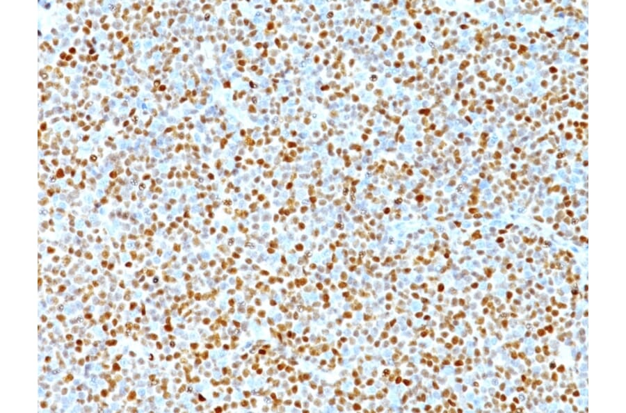 Immunohistochemistry - Anti-Cyclin D1 Antibody [DCS-6] (A249856) - Antibodies.com