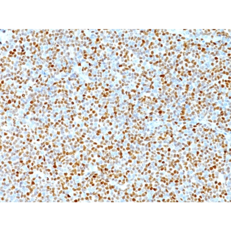 Immunohistochemistry - Anti-Cyclin D1 Antibody [DCS-6] (A249856) - Antibodies.com