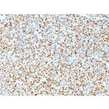 Immunohistochemistry - Anti-Cyclin D1 Antibody [DCS-6] (A249856) - Antibodies.com