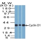 Western Blot - Anti-Cyclin D1 Antibody [DCS-6] (A249856) - Antibodies.com