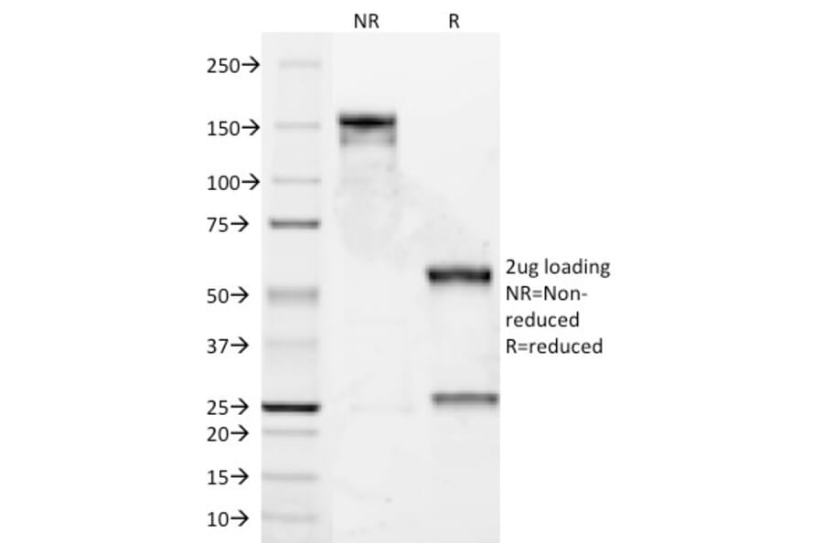 SDS-PAGE - Anti-Cyclin D1 Antibody [DCS-6] (A249856) - Antibodies.com