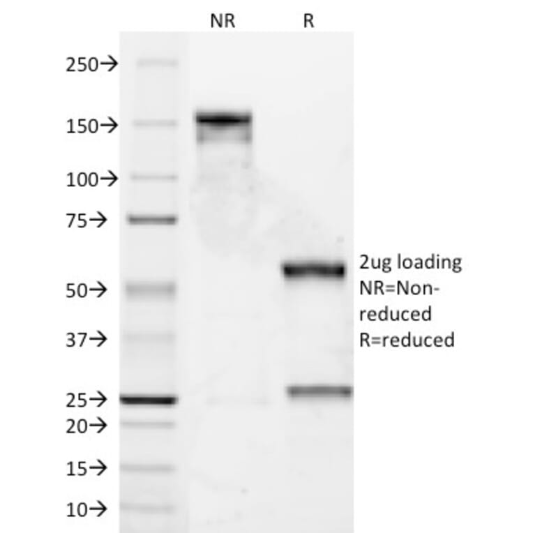 SDS-PAGE - Anti-Cyclin D1 Antibody [DCS-6] (A249856) - Antibodies.com