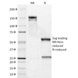 SDS-PAGE - Anti-Cyclin D1 Antibody [DCS-6] (A249856) - Antibodies.com
