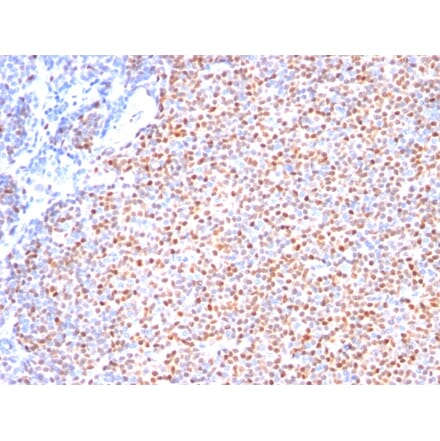 Immunohistochemistry - Anti-Cyclin D1 Antibody [SPM587] (A249856) - Antibodies.com