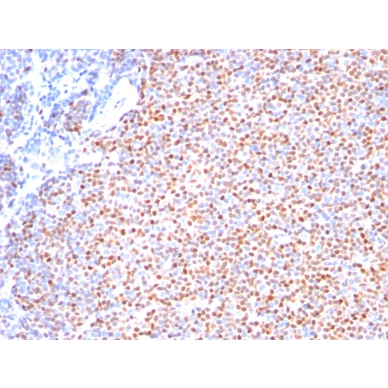 Immunohistochemistry - Anti-Cyclin D1 Antibody [SPM587] (A249856) - Antibodies.com