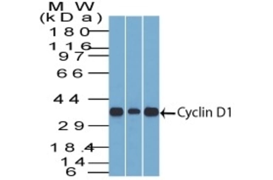 Western Blot - Anti-Cyclin D1 Antibody [SPM587] (A249857) - Antibodies.com