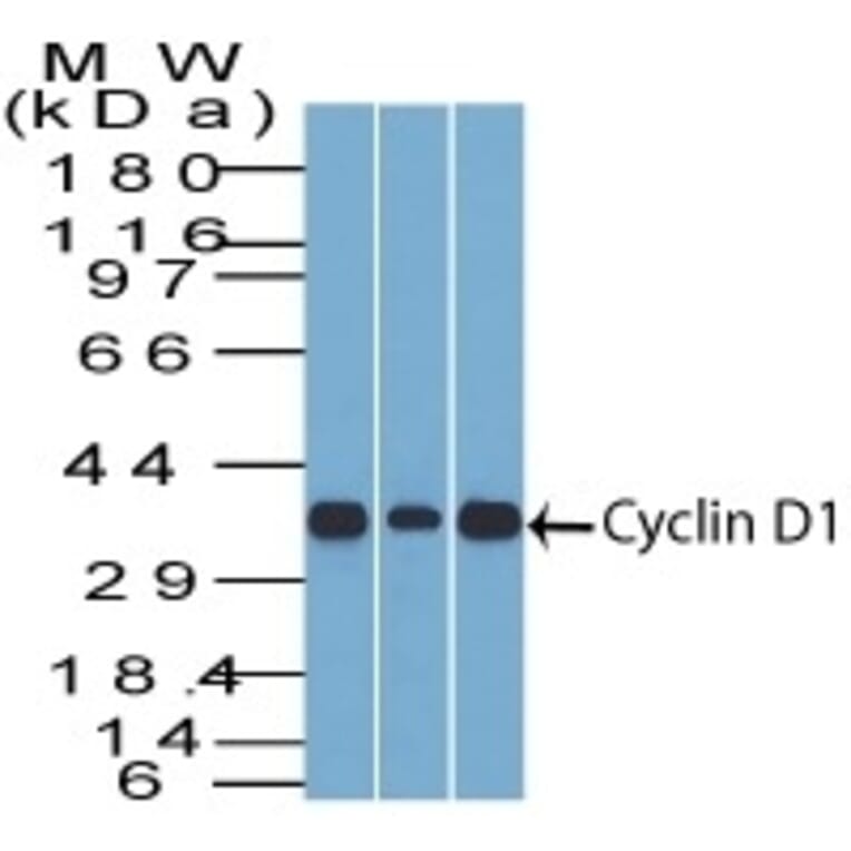 Western Blot - Anti-Cyclin D1 Antibody [SPM587] (A249857) - Antibodies.com