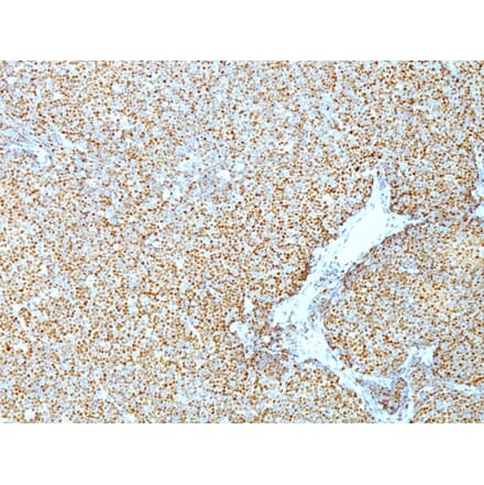 Immunohistochemistry - Anti-Cyclin D1 Antibody [CCND1/809] (A249858) - Antibodies.com